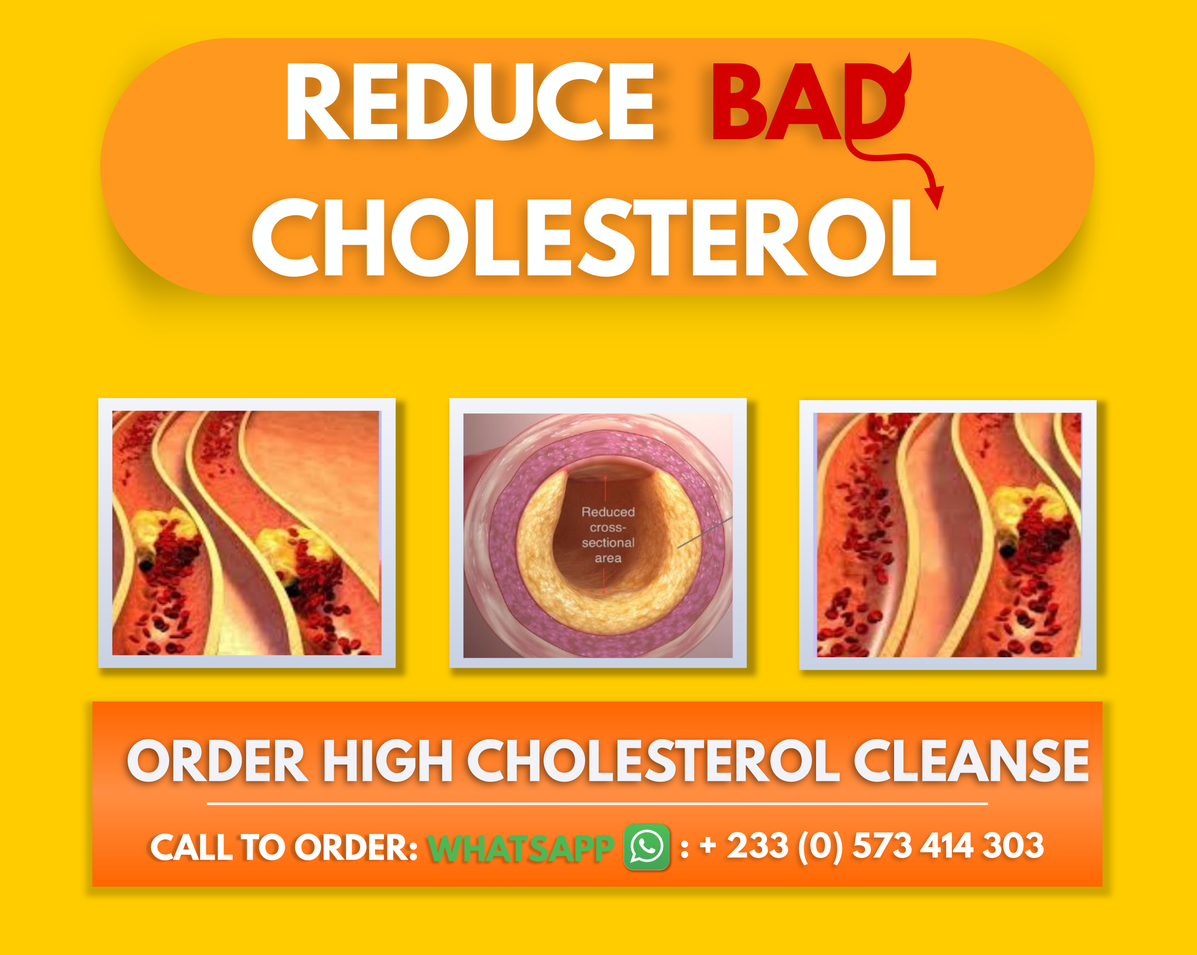 Reduce Cholesterol Naturally